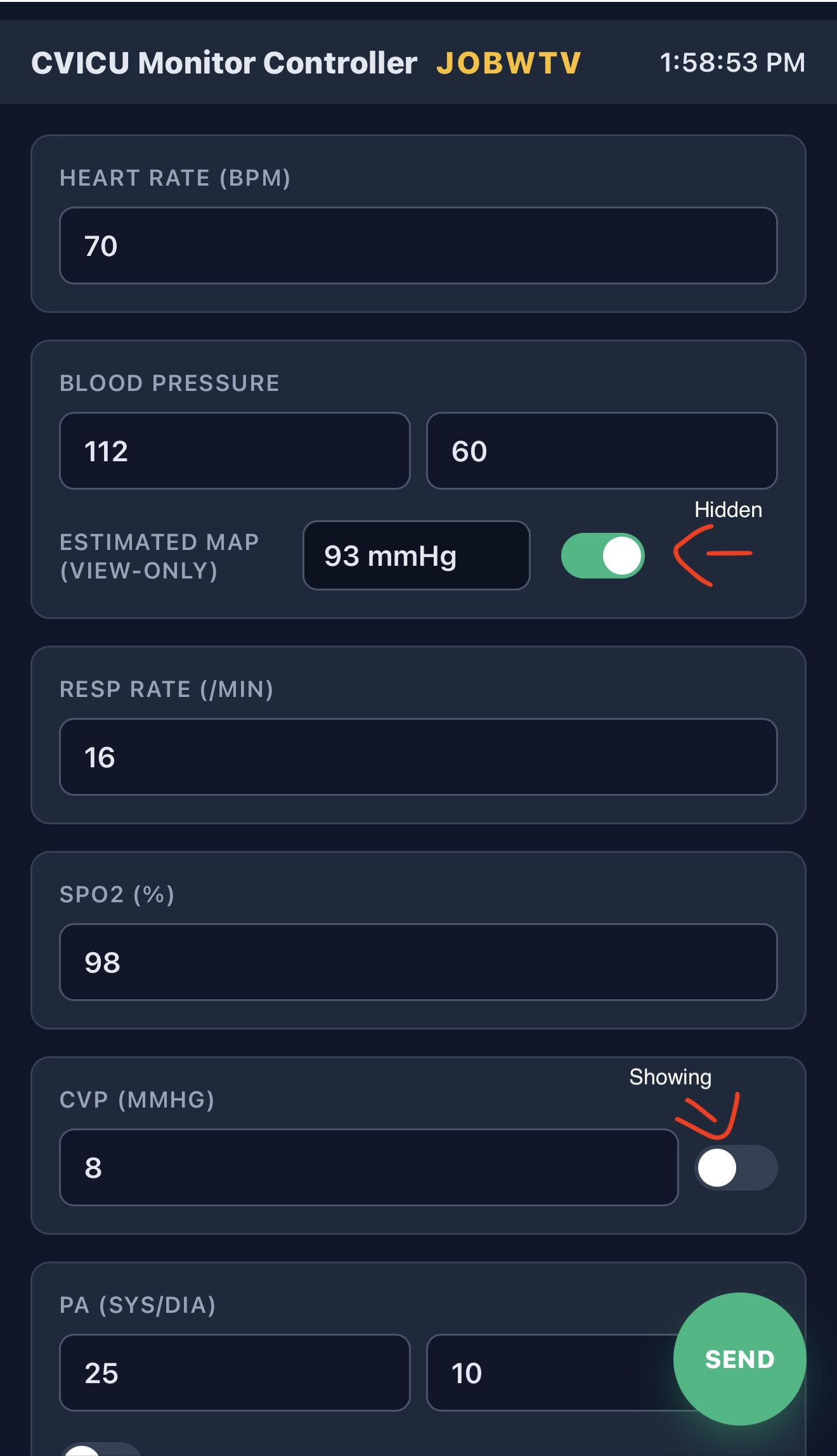 LVAD parameters view
